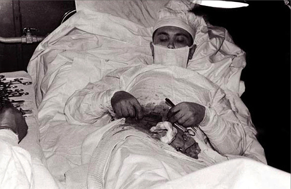 [AppendicitisAntarcticaRussian.jpg]
Dr. Leonid Rogozov removing his own appendix in Antarctica, 1961 (Novolazarevskaya Station)